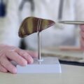 Jak poprawić próby wątrobowe bez rewolucji w codziennych nawykach?